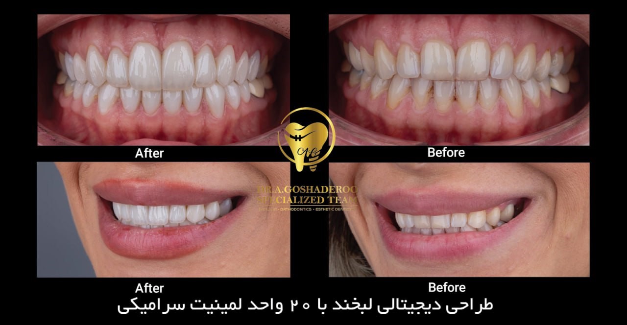 طراحی لبخند دیجیتال