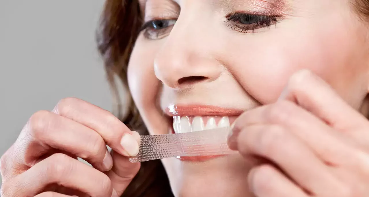 چسب سفید کننده دندان