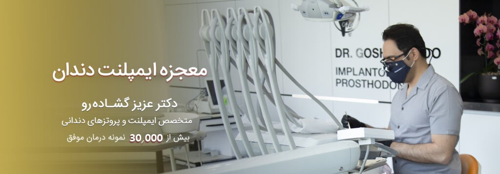 ایمپلنتهای دندانی