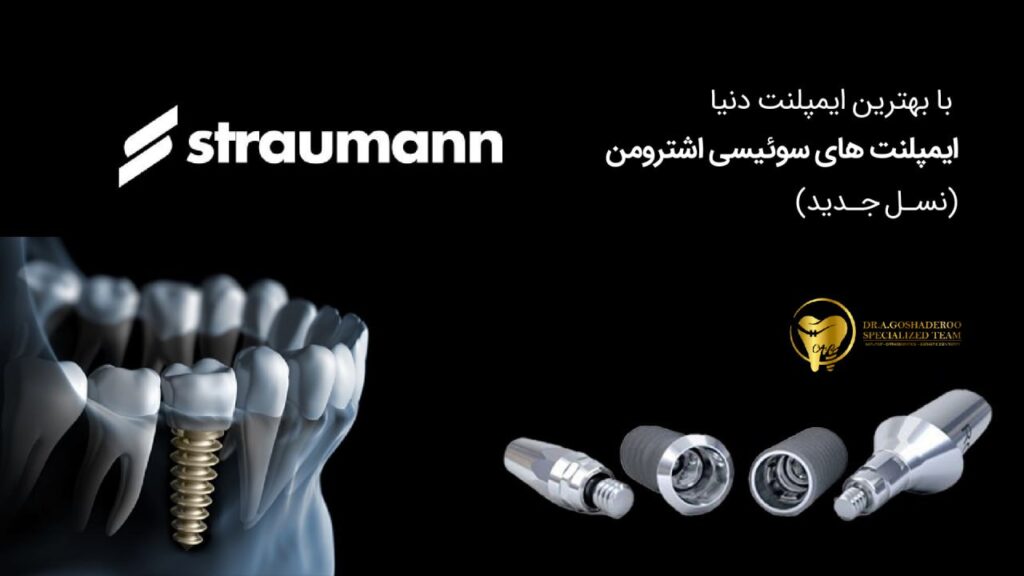 نسل جدید ایمپلنتهای دندانی