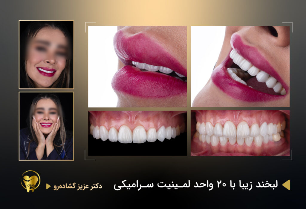  بهترین دندانپزشک متخصص ایمپلنت و زیبایی در الهیه 