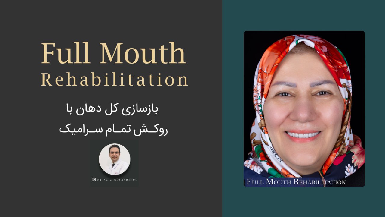 بازسازی کل دهان با روکش تمام سرامیک