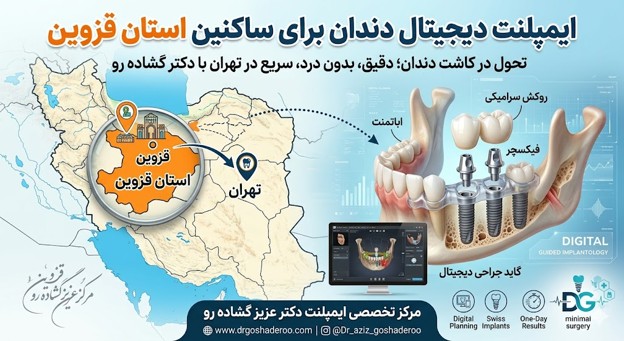 بهترین دکتر ایمپلنت دیجیتال قزوین؛ چرا قزوینی‌ها برای کاشت دندان به تهران می‌آیند؟