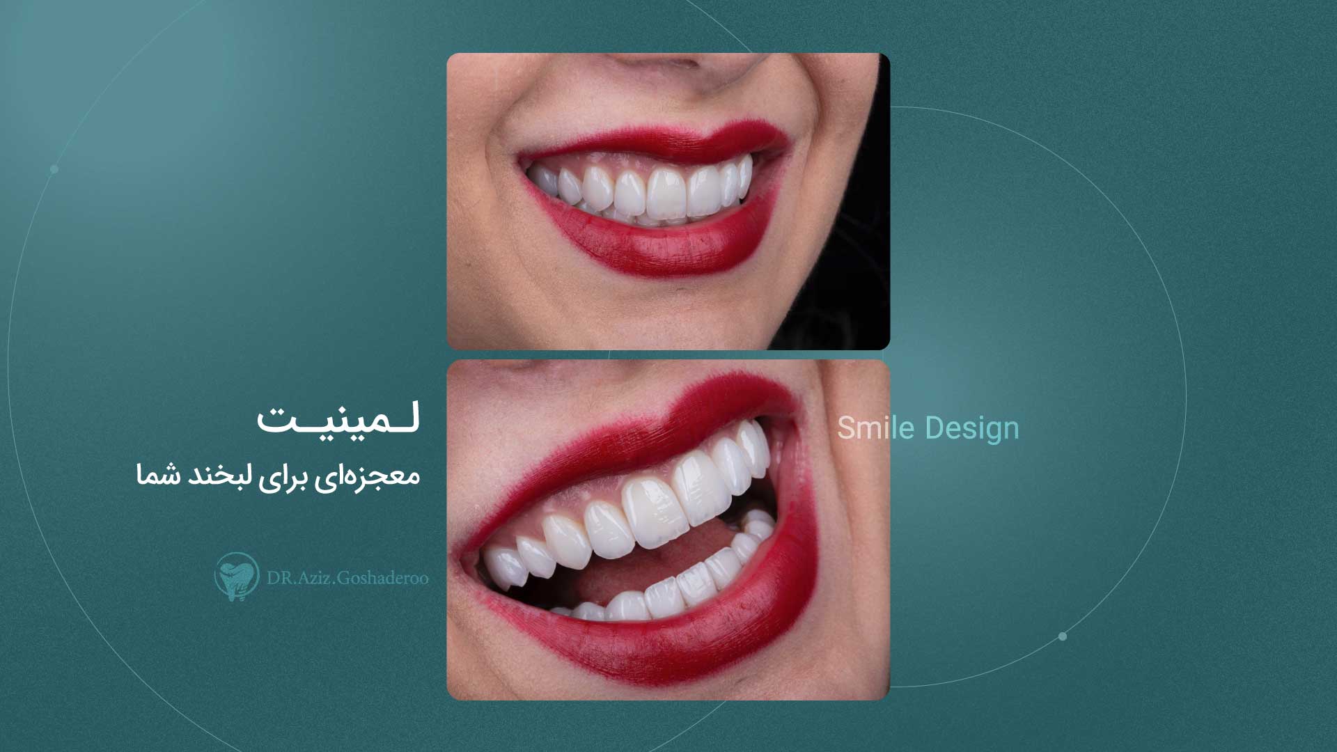 Klaas - Dentist website Webflow template