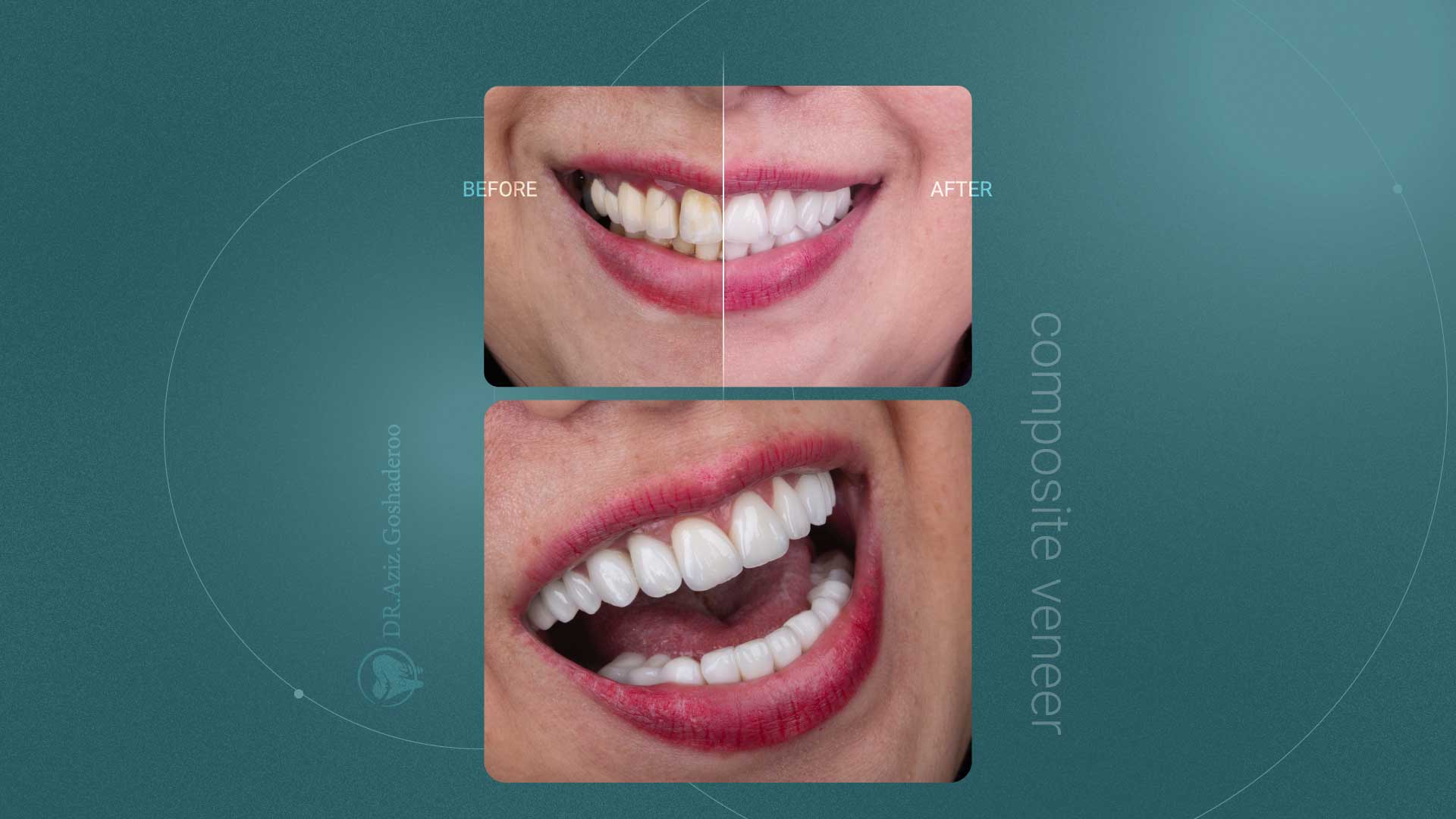 Klaas - Dentist website Webflow template