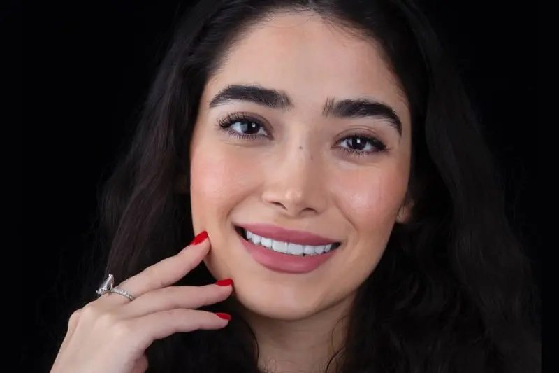 قیمت ایمپلنت دندان در تهران