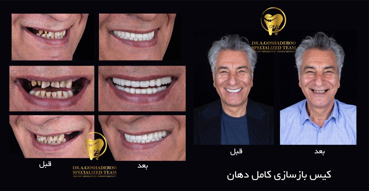 جراحی دندان با آرامبخشی چیست؟