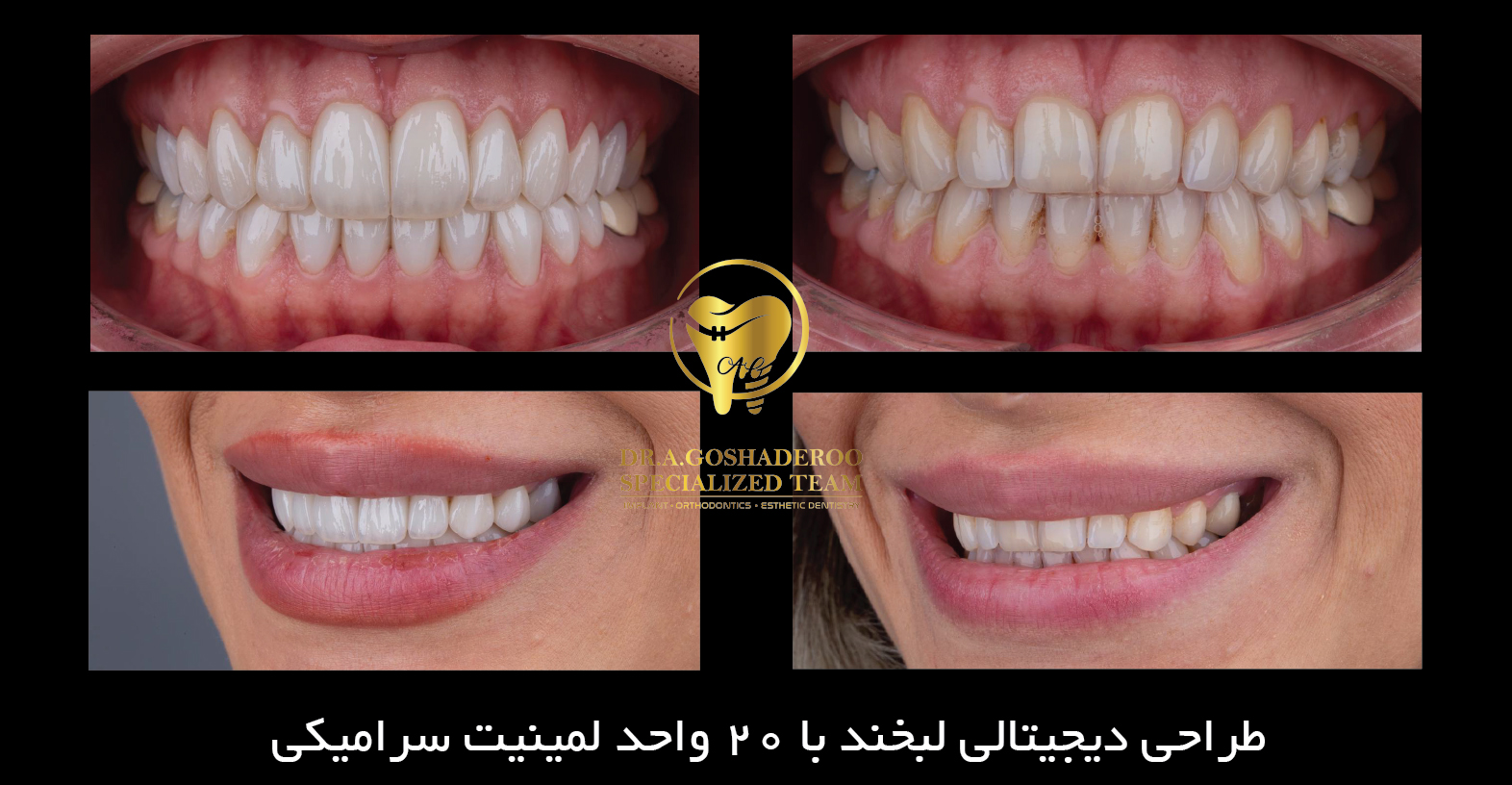 خدمات دندانپزشکی زیبایی در تهران