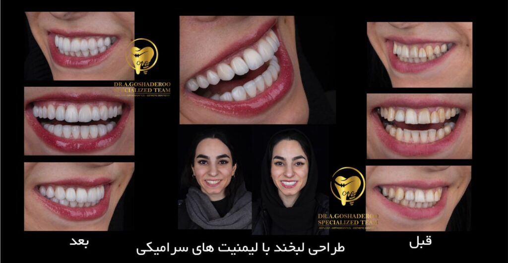 چگونه بهترین روش زیبایی دندان برای شما انتخاب می‌شود؟