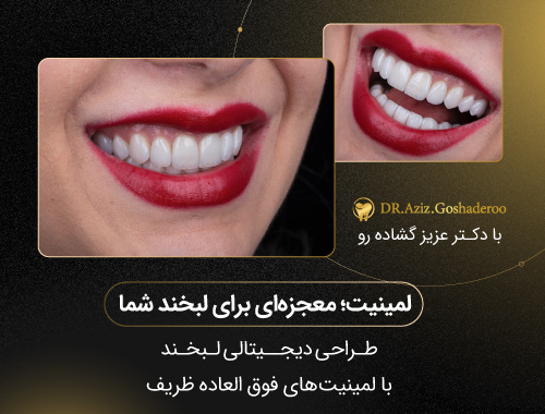 هزینه دندانپزشکی زیبایی در تهران چگونه محاسبه می‌شود؟