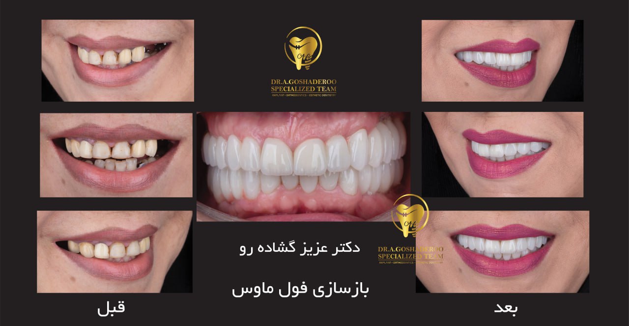 دندانپزشکی زیبایی