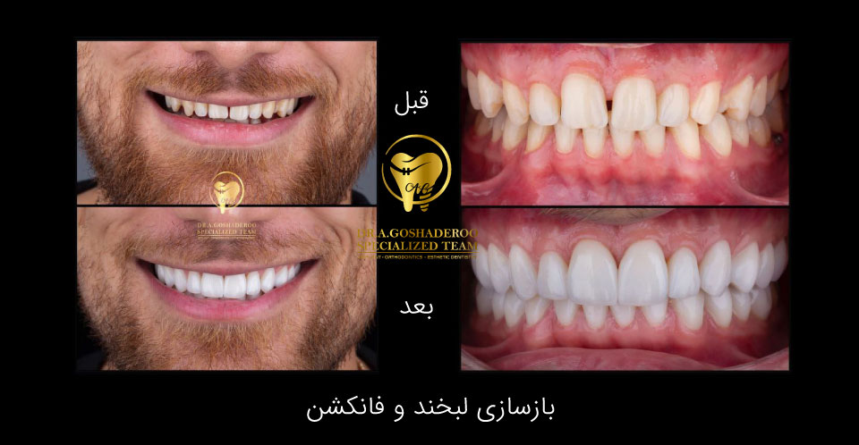 دندانپزشکی زیبایی