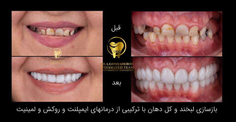 دندانپزشکی زیبایی