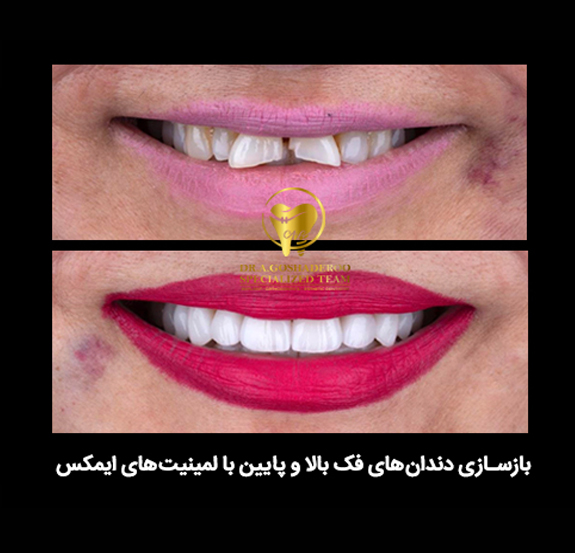 دندانپزشکی زیبایی