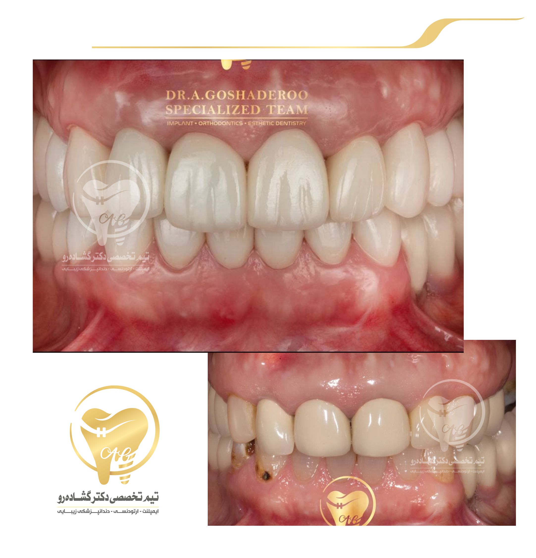 دندانپزشکی زیبایی