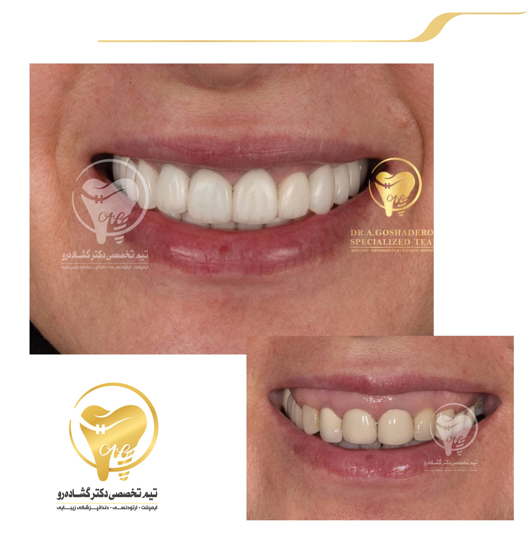 دندانپزشکی زیبایی