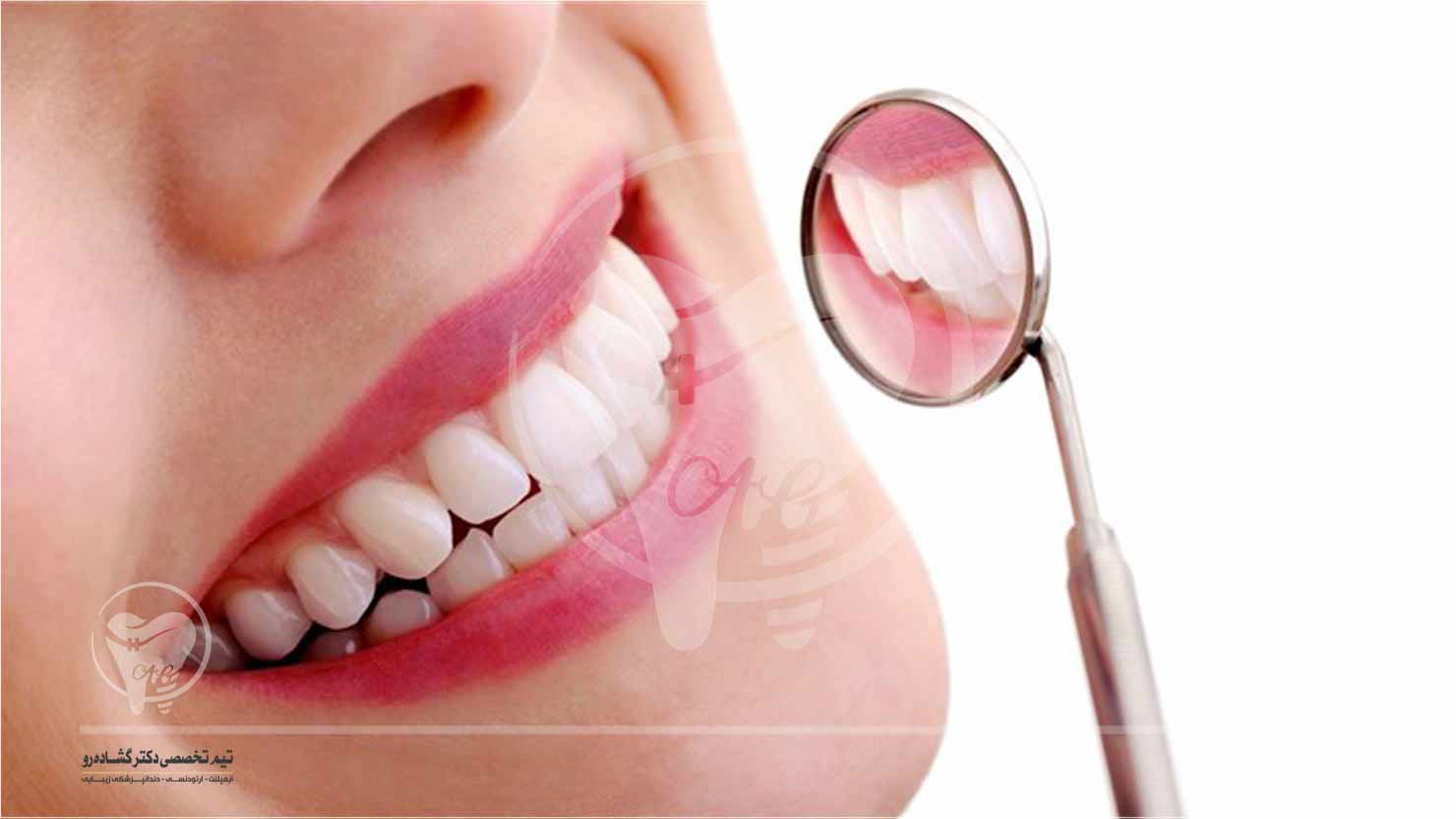 دندانپزشک زیبایی کیست و معیار های بهترین دندانپزشک زیبایی چیست؟