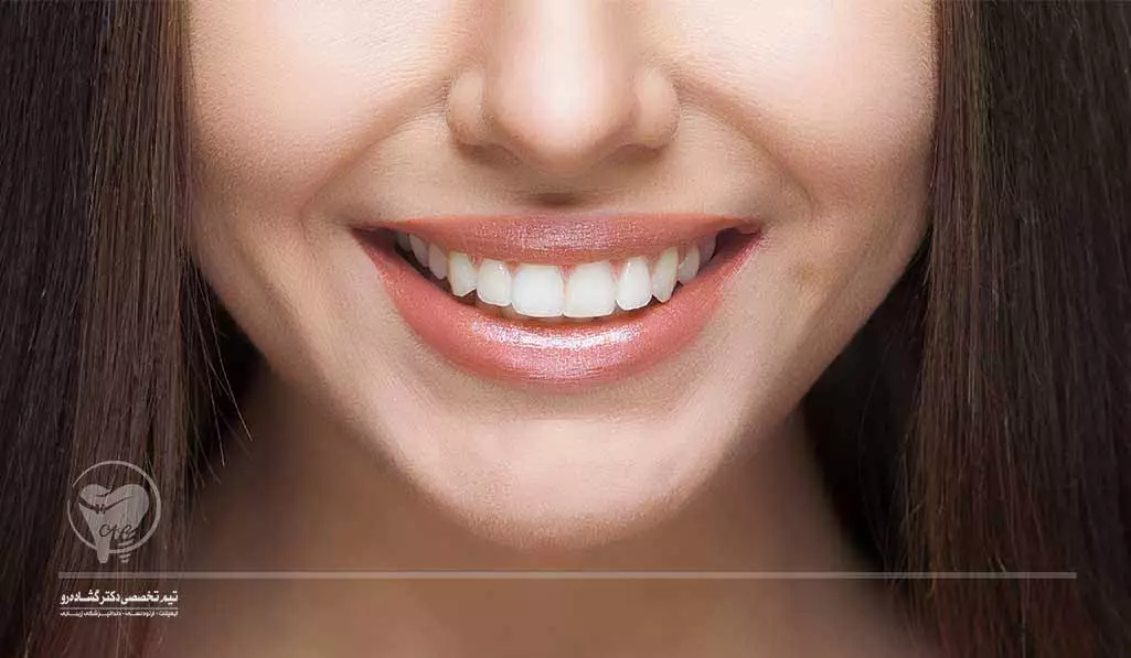 0 تا 100 طراحی لبخند دیجیتال