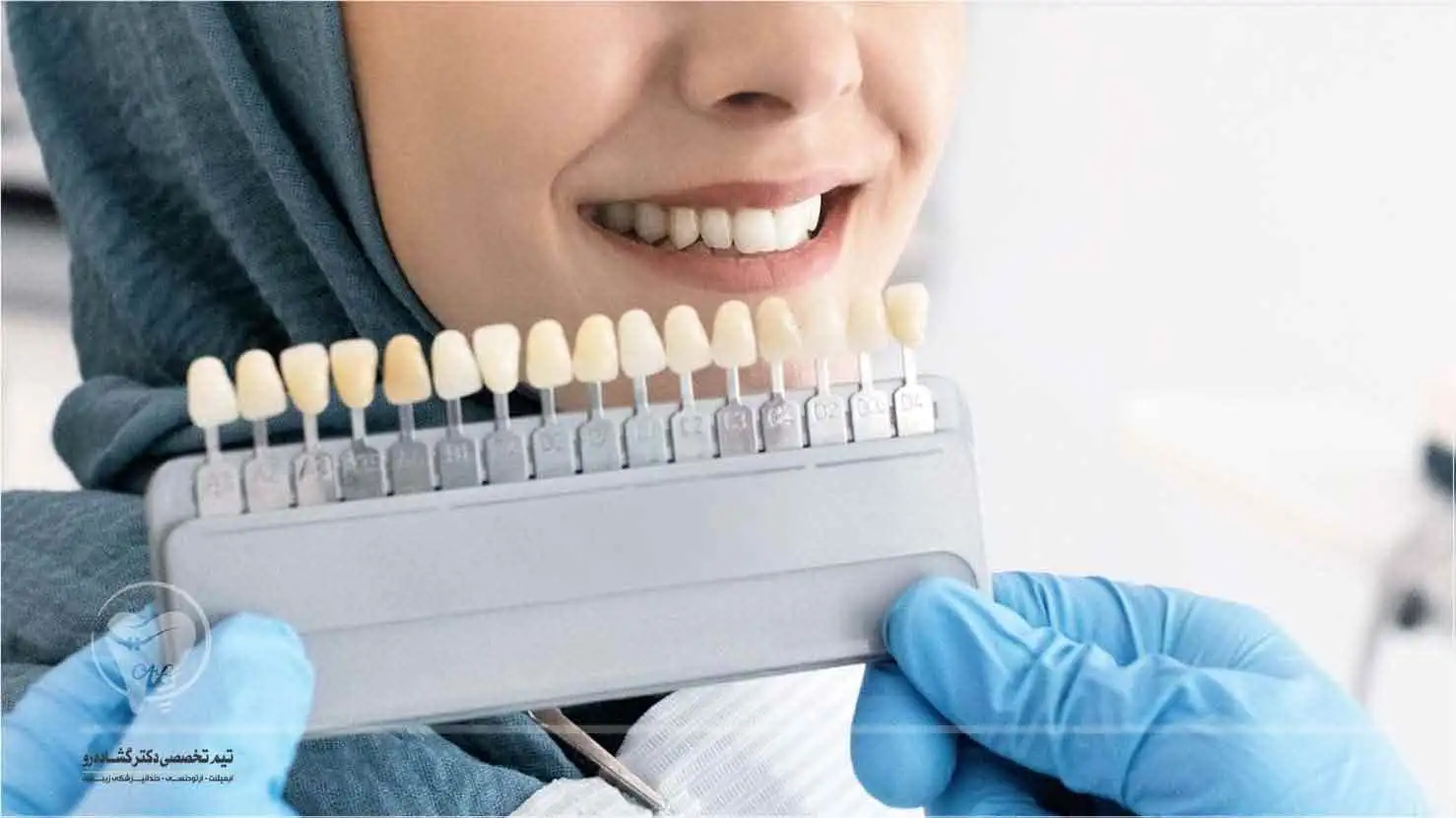 ونیر کامپوزیت دندان چیست؟ دندانپزشکی زیبایی