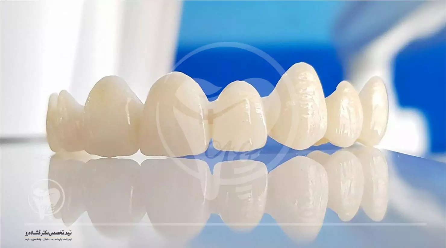 روکش دندان تمام سرامیک برای چه کسانی مناسب است؟