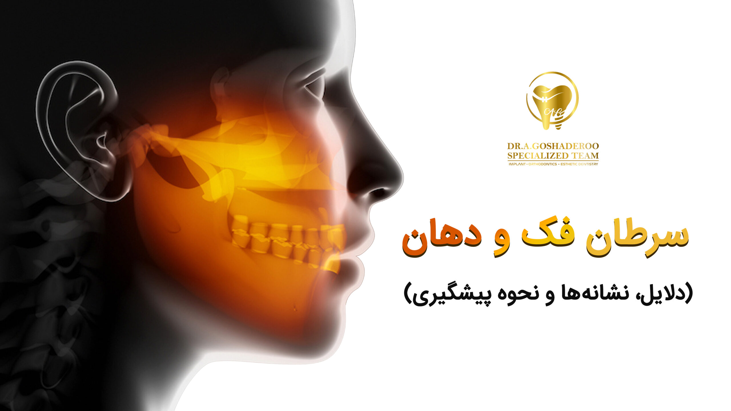 سرطان فک و دهان  چیست؟ علائم و نشانه ها- درمان