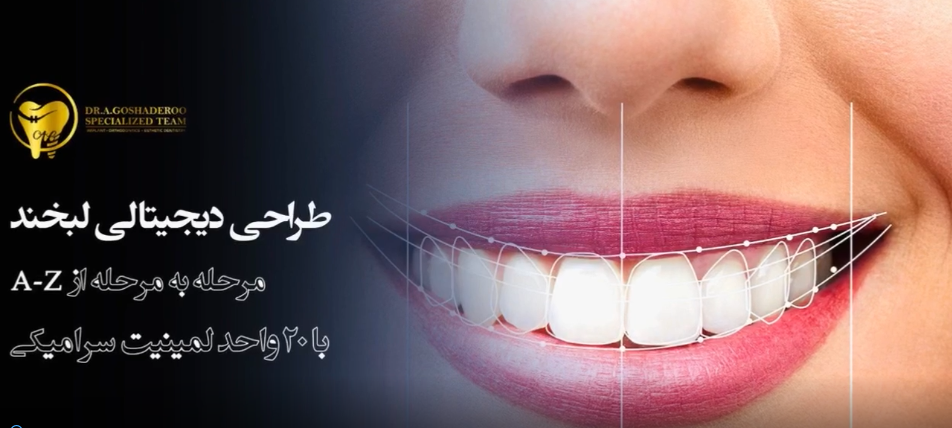 طراحی لبخند دیجیتالی مرحله به مرحله