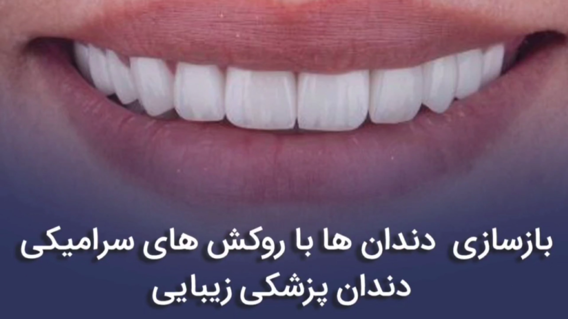 خدمات دندان پزشکی زیبایی _ مزایا و معایب