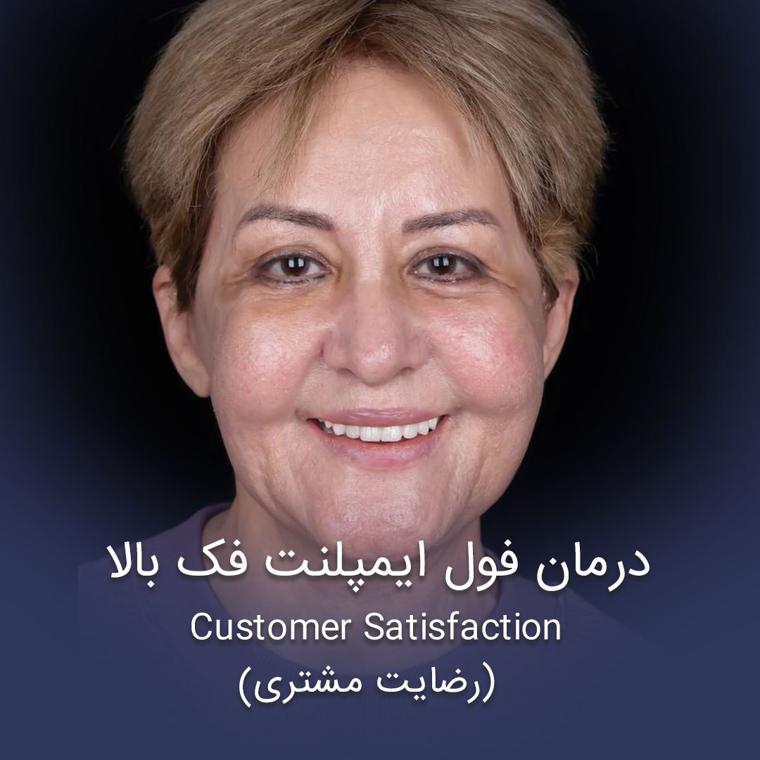 درمان فول ایمپلنت فک بالا _ رضایت مشتری