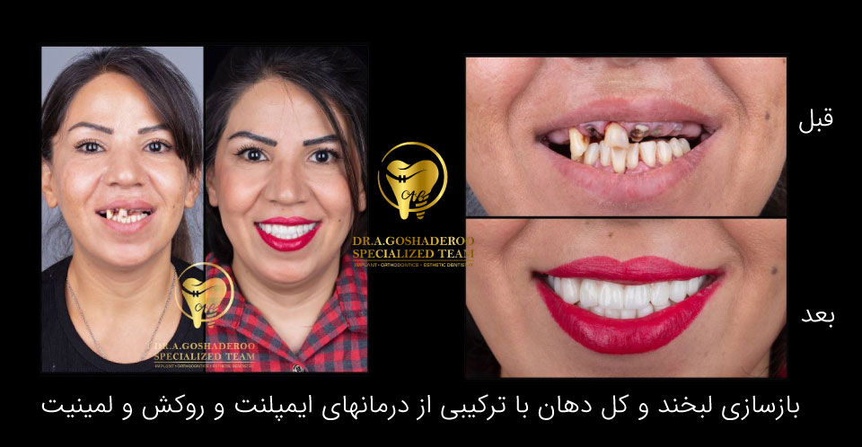 لبخند جذاب،صورت جذاب