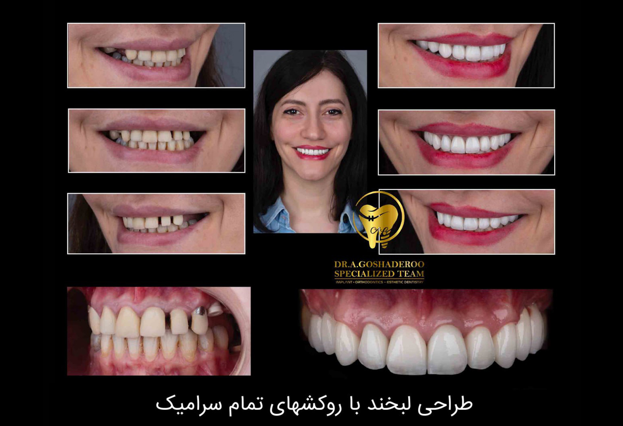 لبخند جذاب،صورت جذاب