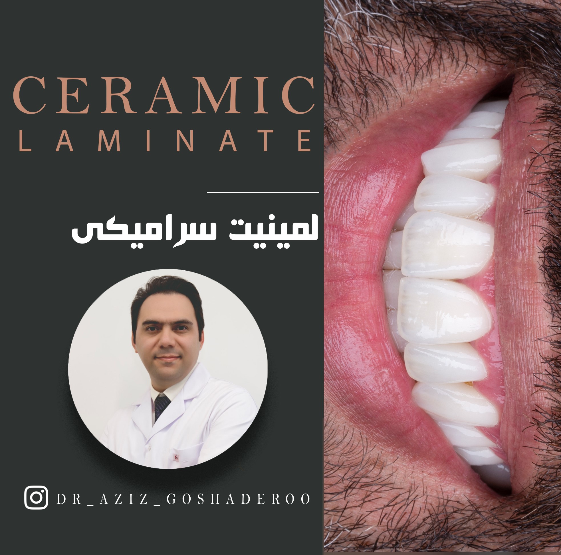 طراحی لبخند طبیعی