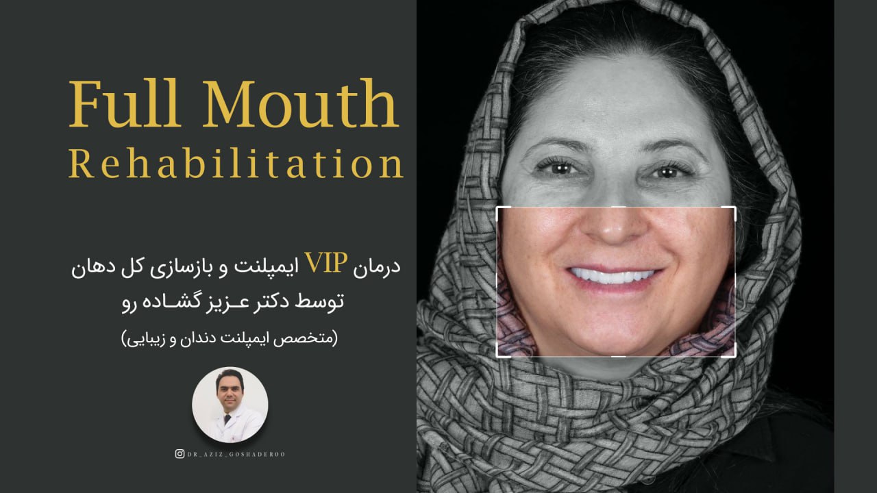 درمان(VIP) ایمپلنت و بازسازی کل دهان