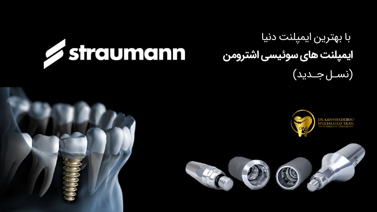 نسل جدید ایمپلنت‌های دندانی — تحولی در دقت، سرعت و دوام