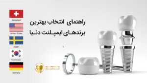 بهترین برندهای ایمپلنت دنیا