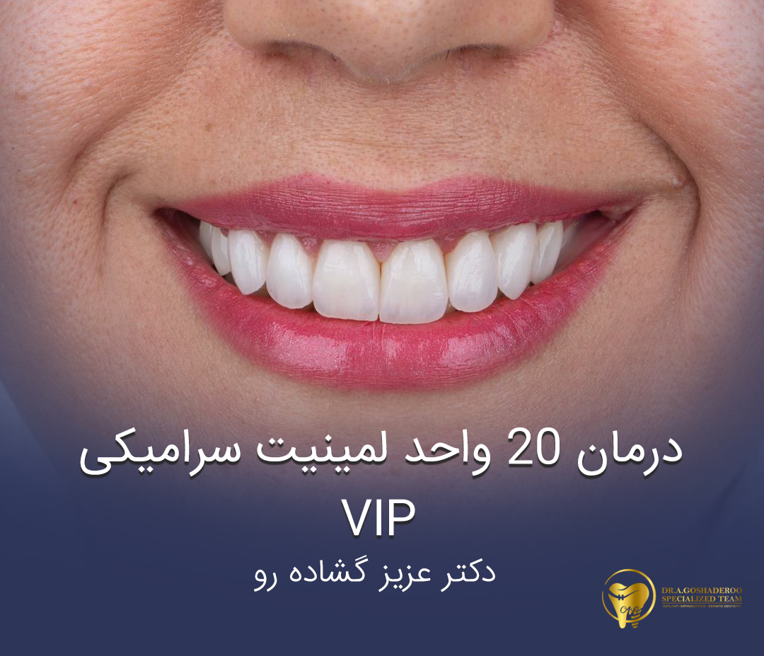 درمان 20واحد لمینیت سرامیکی vip