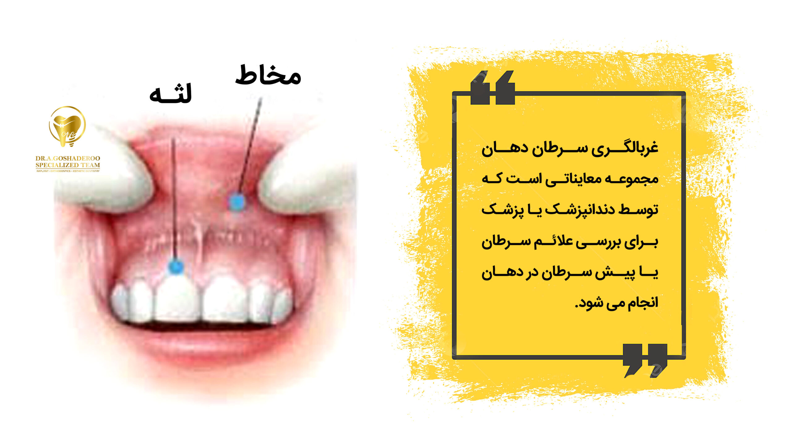 اینفوگرافیک 8 مرحله غربالگری سرطان دهان