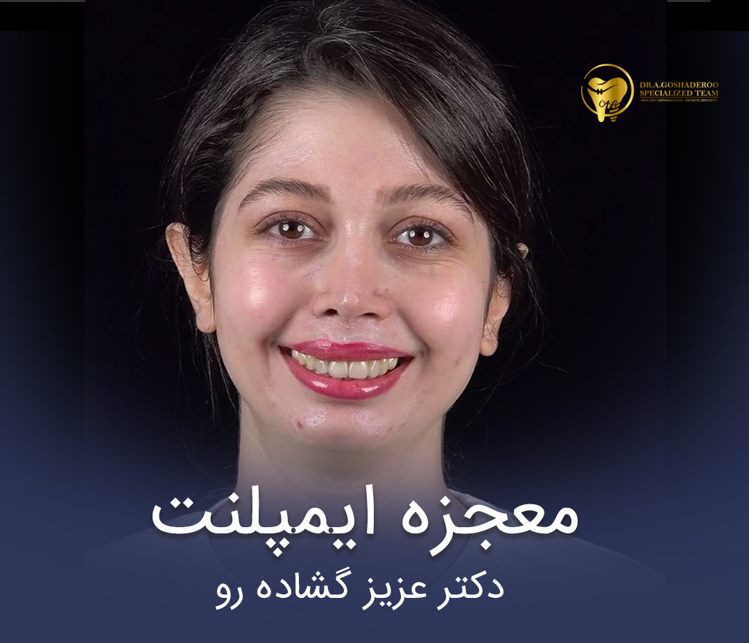 رضایت بیمار از درمان ایمپلنت