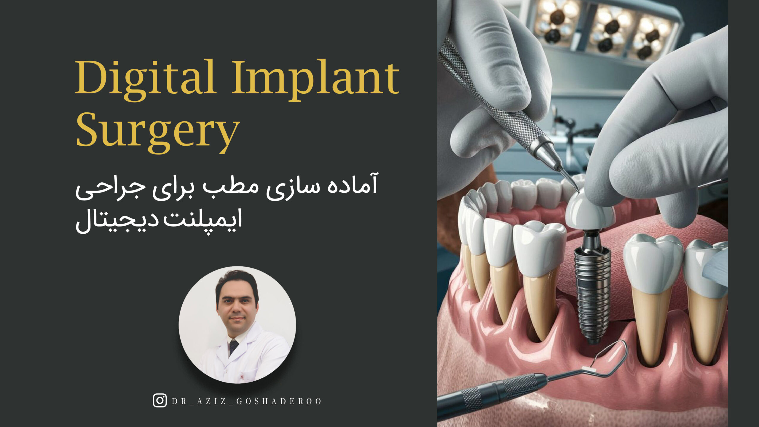 آماده سازی مطب برای ایمپلنت دیجیتال