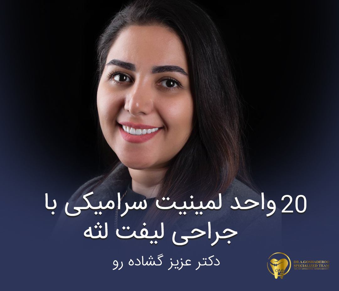 20 واحد لمینیت سرامیکی با جراحی لیفت لثه _ دکتر عزیز گشاده رو